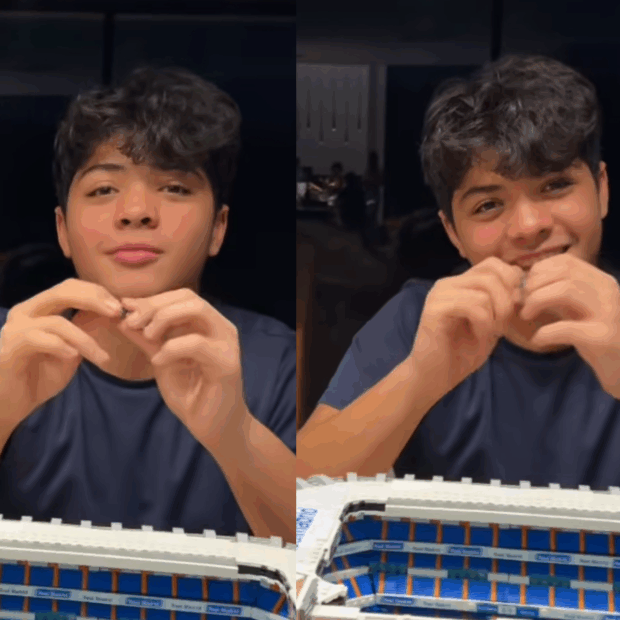 Adolescente de 14 anos aparece sorridente nas redes da mãe após remover tumor benigno na cabeça e mostra que está cheio de energia.