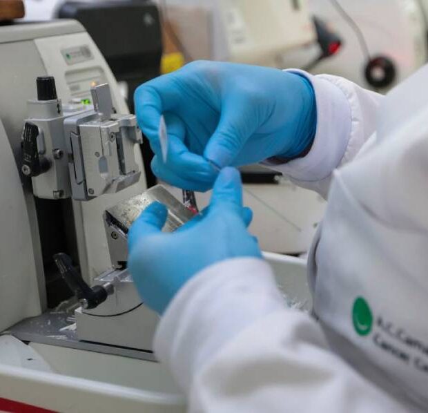 câncer de próstata (1)