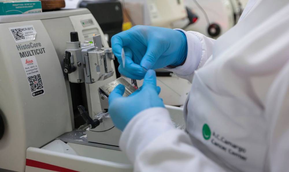 câncer de próstata (1)