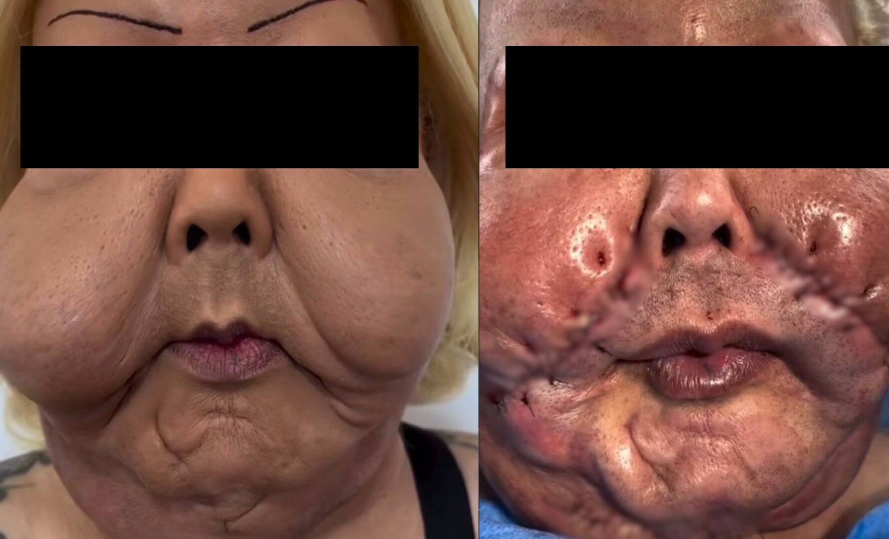 g1 2025 11 23t125151.287