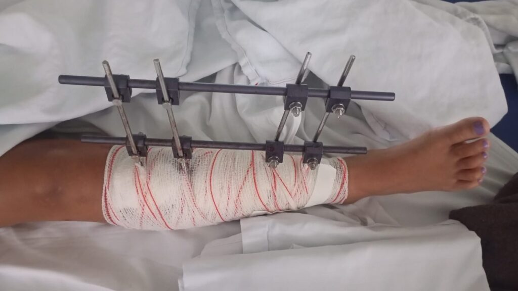 64011c15 ddf8 4f97 be6d 7bb83be9167e