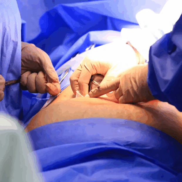 Foto ilustrativa: Breno Esaki/Agência Saúde DF