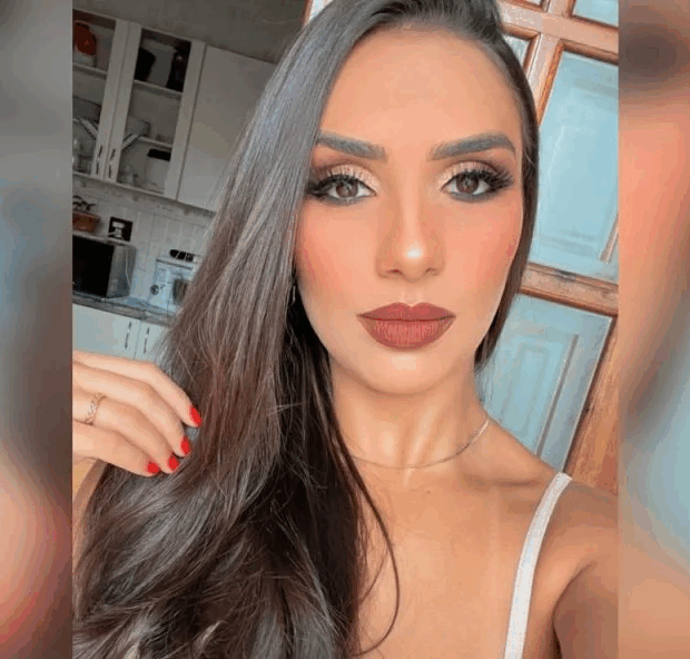 engenheira lana david morre apos silicone 3 960x592