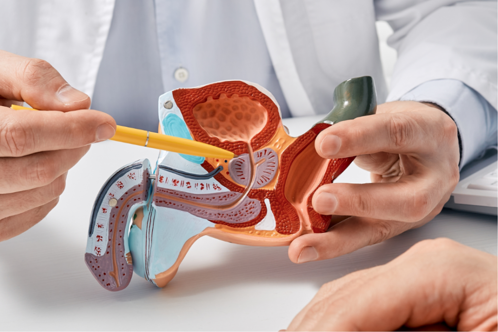 cancere de prostasta (1)