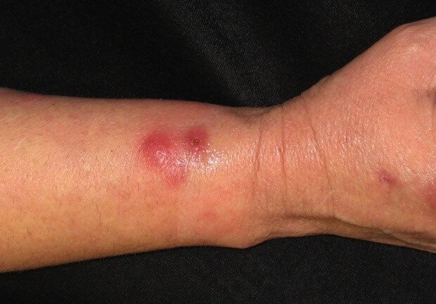 Foto: Domínio Público / UFRB