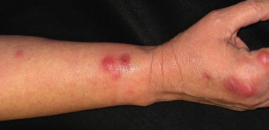 Foto: Domínio Público / UFRB