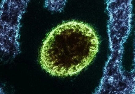 vírus nipah