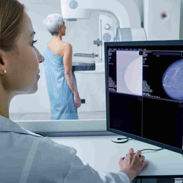 mamografia