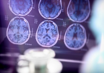 Foto: Divulgação/IgesDF