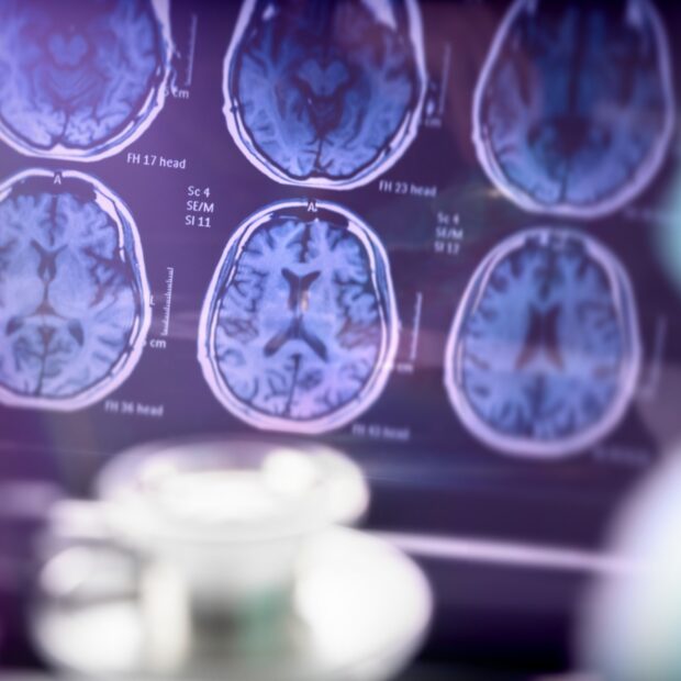 Foto: Divulgação/IgesDF