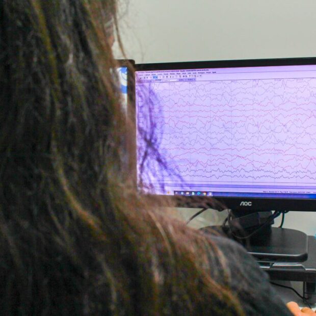 hcb epilepsia exame foto maria clara oliveira img 1415