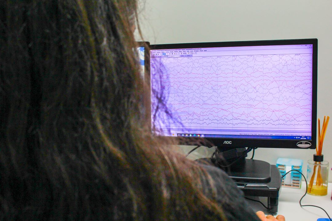 hcb epilepsia exame foto maria clara oliveira img 1415