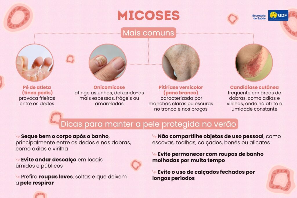 Foto: Divulgação/SES-DF