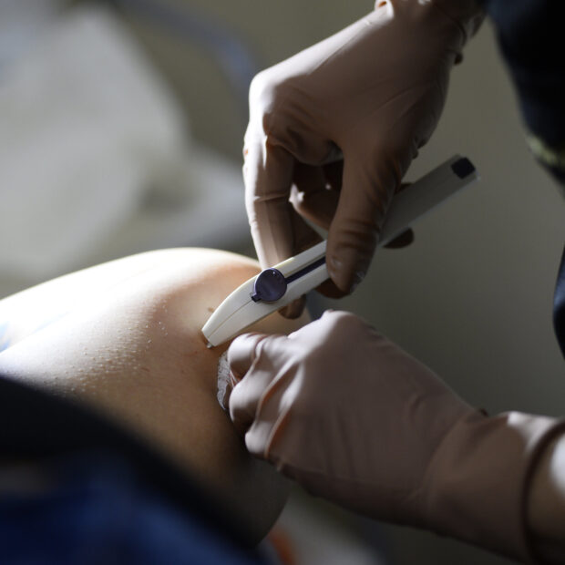 07022026 implanon na atenção primária fotos matheus oliveira agência saúde df (1)