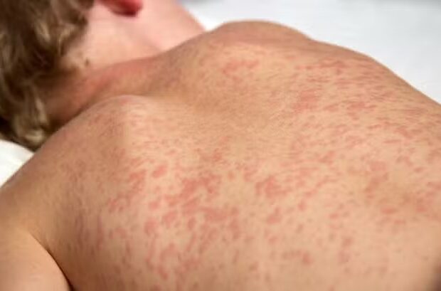 Foto: Reprodução/Governo Federal