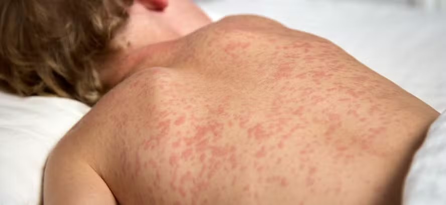 Foto: Reprodução/Governo Federal