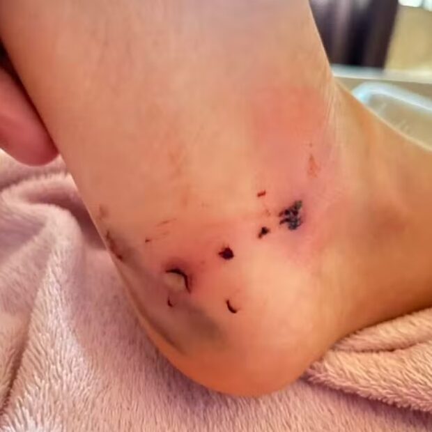 Criança atacada por cachorro em Porto Velho — Foto: Reprodução/redes sociais