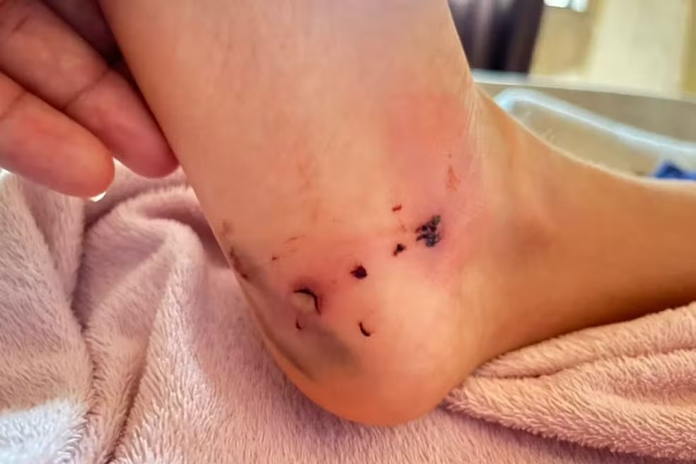 Criança atacada por cachorro em Porto Velho — Foto: Reprodução/redes sociais