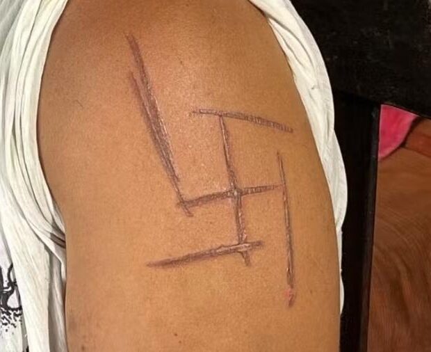 mulher é torturada e tem suástica marcada na pele