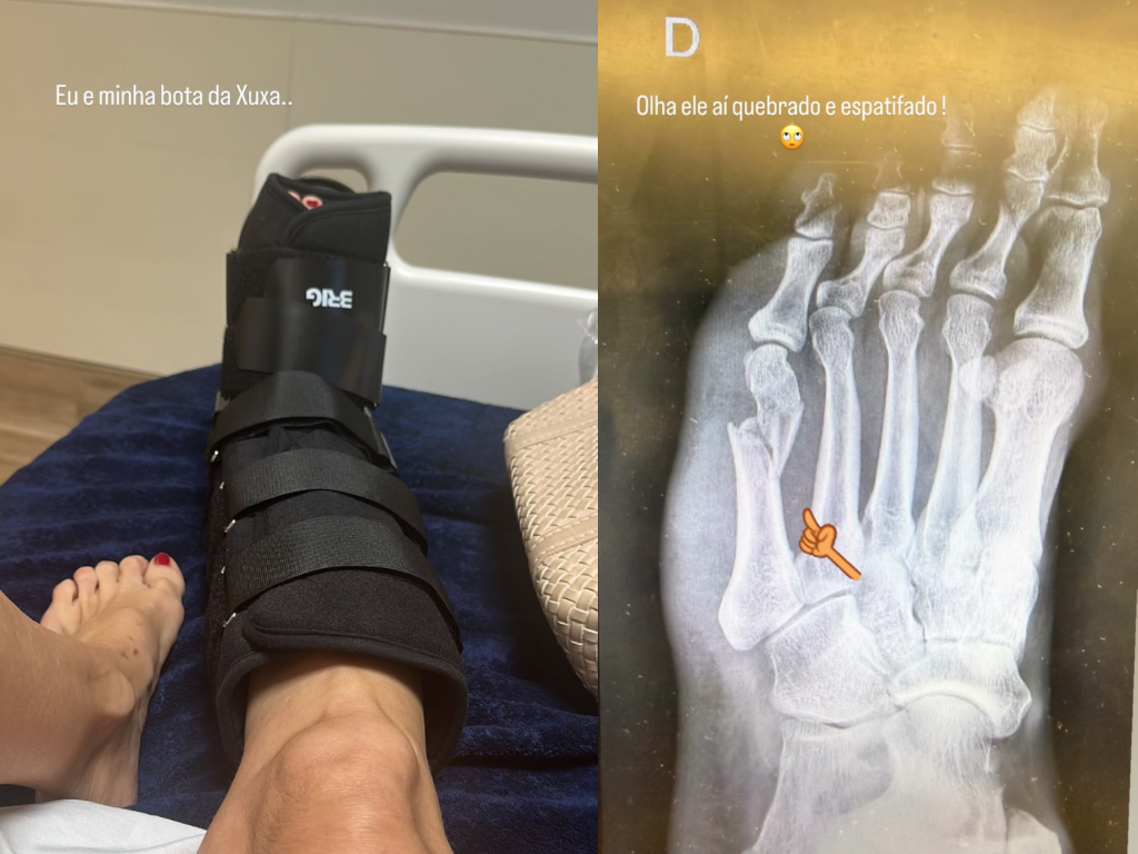 cópia de cópia de moldeld 2