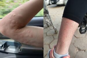 infestação de maruim obriga moradores a viver com portas fechadas em cidade de sc duelam por palanques, barram candidaturas e priorizam alianças amplas jornal de brasilia