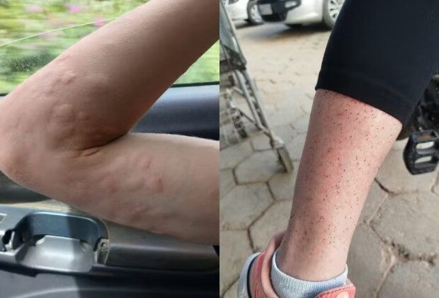 infestação de maruim obriga moradores a viver com portas fechadas em cidade de sc duelam por palanques, barram candidaturas e priorizam alianças amplas jornal de brasilia