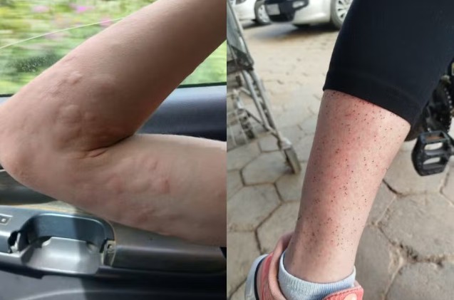 infestação de maruim obriga moradores a viver com portas fechadas em cidade de sc duelam por palanques, barram candidaturas e priorizam alianças amplas jornal de brasilia