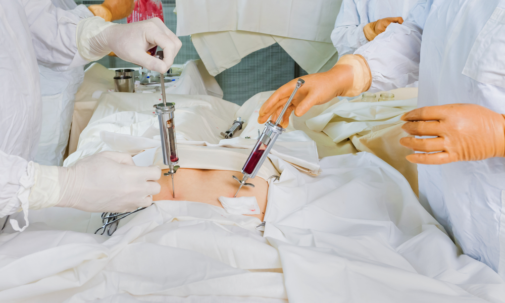 Ministério da Saúde anuncia redução de importações de medula óssea e depois recua