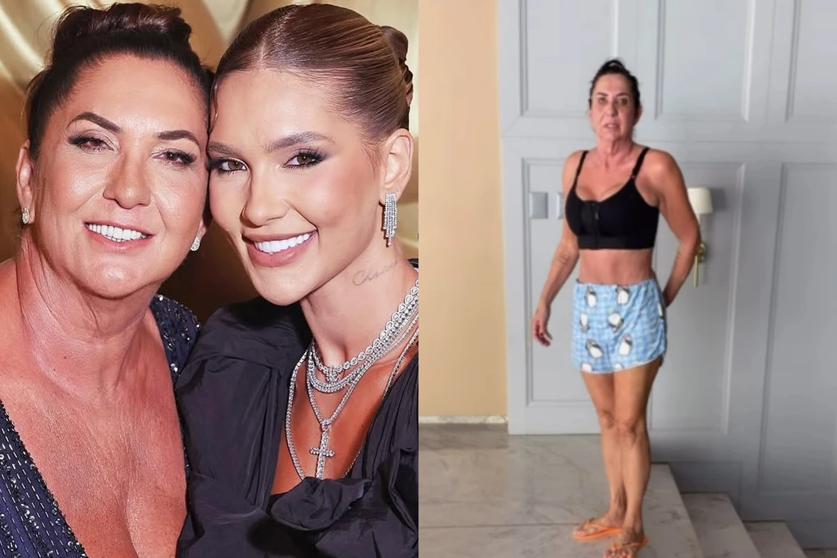 virginia exibe novo visual da mae apos serie de cirurgias