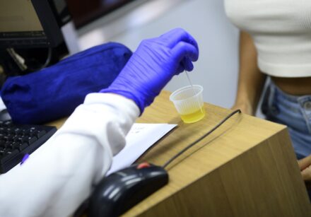 30.4. exame de urina foto matheus oliveira agência saúde df