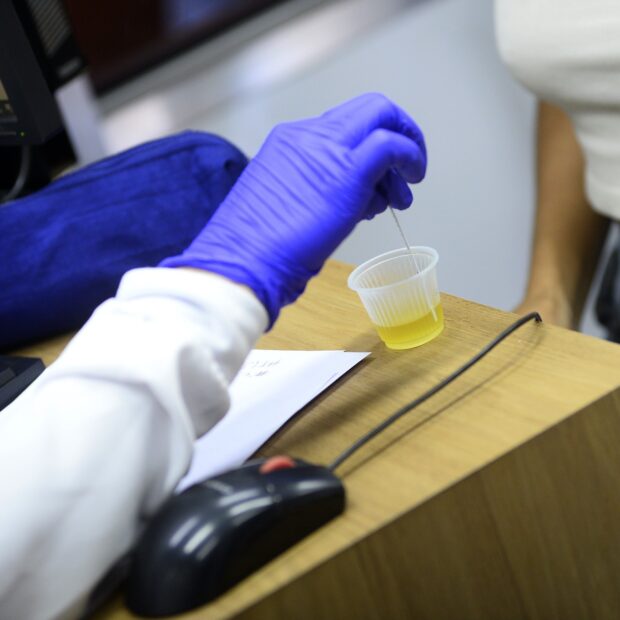 30.4. exame de urina foto matheus oliveira agência saúde df