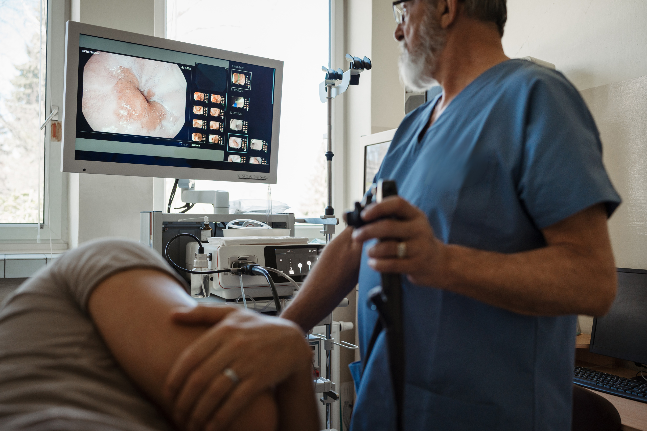 IgesDF abre edital para compra de sistemas de videoendoscopia ao HBDF