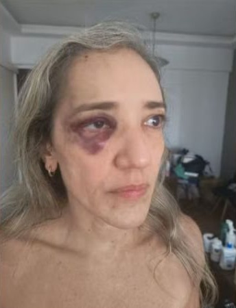 agressão após questionar capacete no Rio
