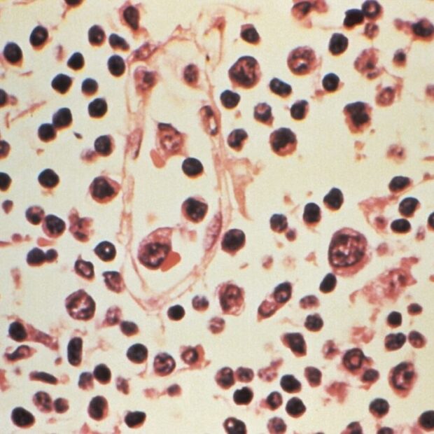 Foto: Handout / US Centers For Disease Control And Prevention (CDC) / AFP