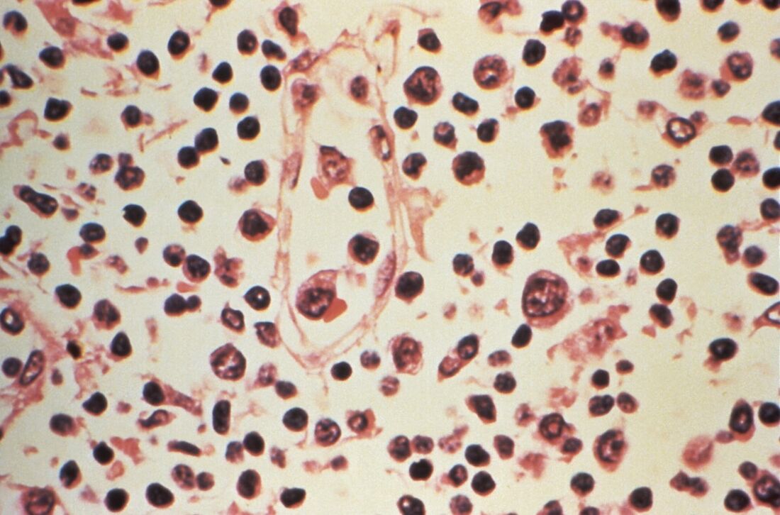Foto: Handout / US Centers For Disease Control And Prevention (CDC) / AFP