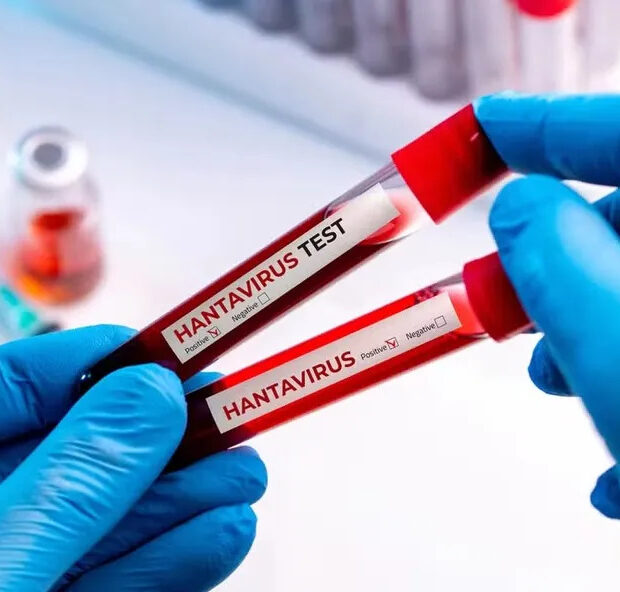 hantavirus