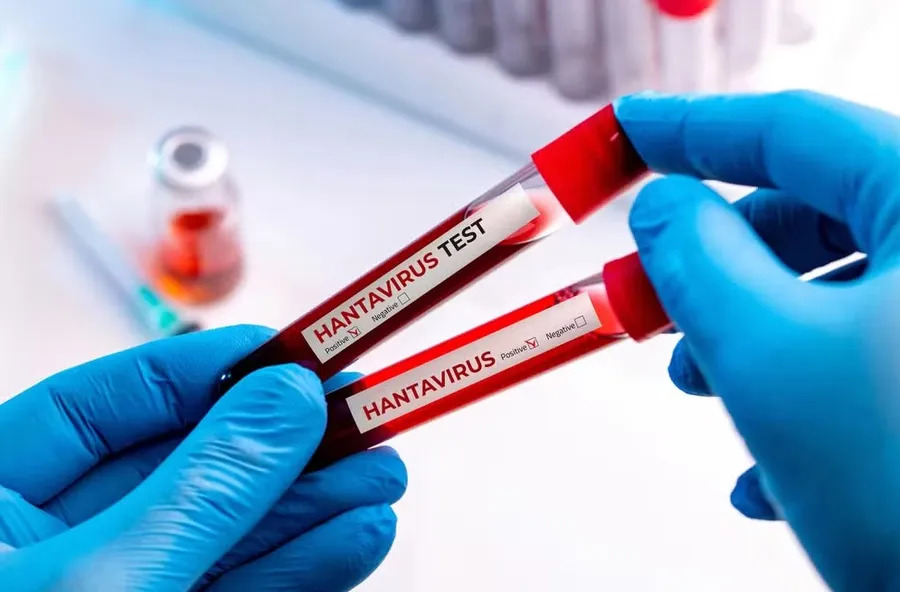 Entenda a diferença entre hantavírus e coronavírus e por que nova pandemia é descartada