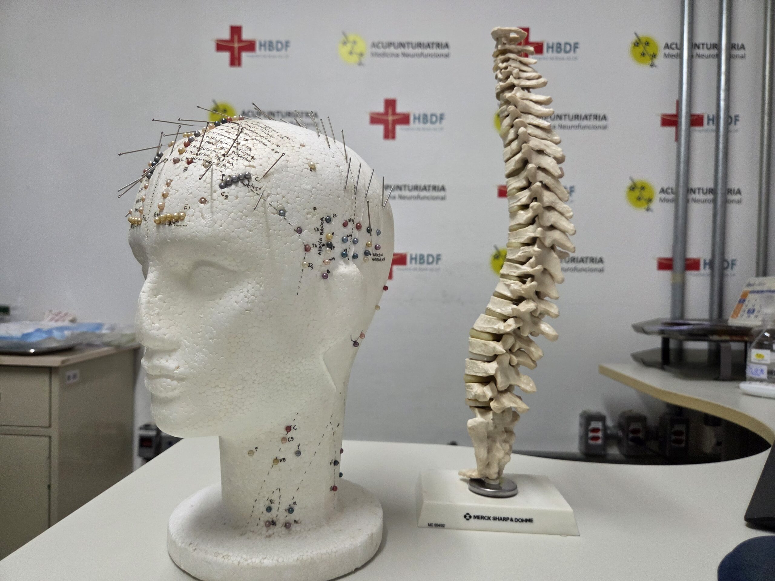 HBDF inicia capacitação em acupuntura médica avançada para controle de dor