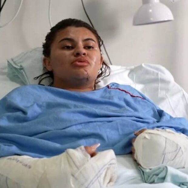 estudante que teve as mãos amputadas em ataque com foice