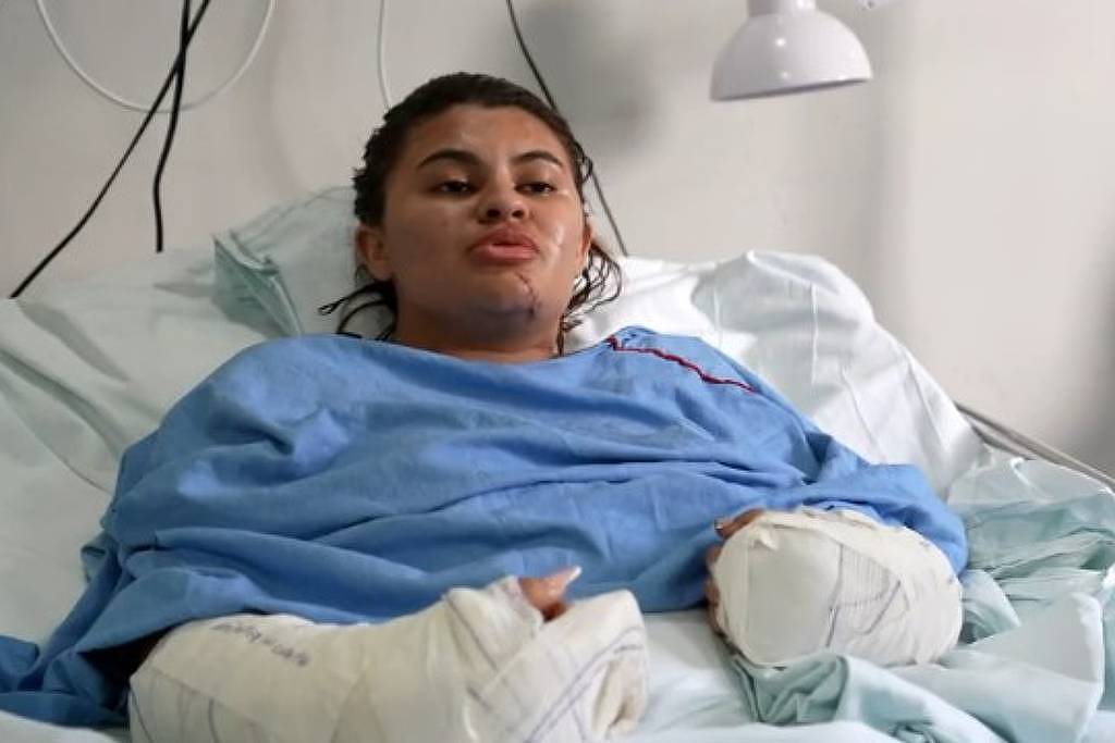 estudante que teve as mãos amputadas em ataque com foice