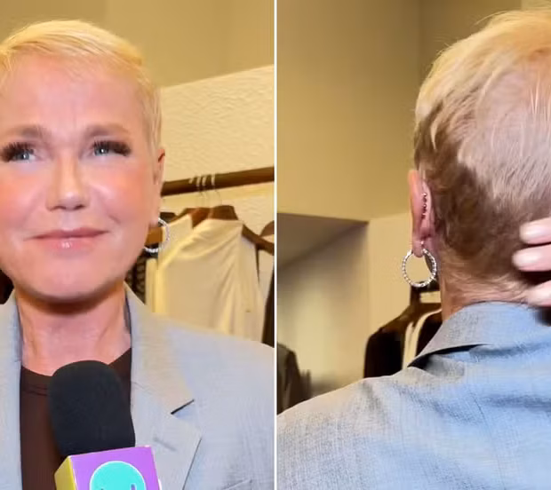 xuxa mostra resultado de transplante capilar
