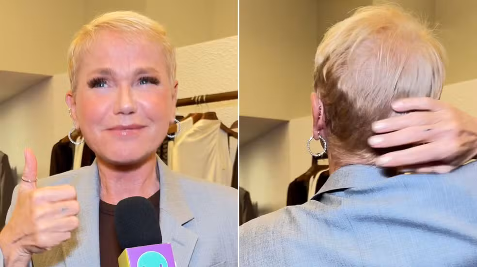 xuxa mostra resultado de transplante capilar