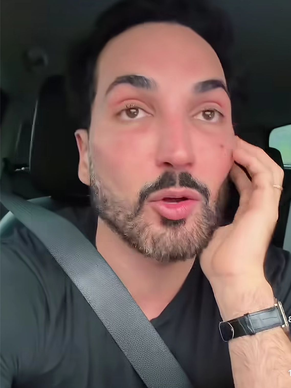 Lucas Estevam, do perfil Estevam Pelo Mundo, mostrou os ferimentos após ser vítima de assalto em São Paulo e fez um alerta importante sobre segurança digital.