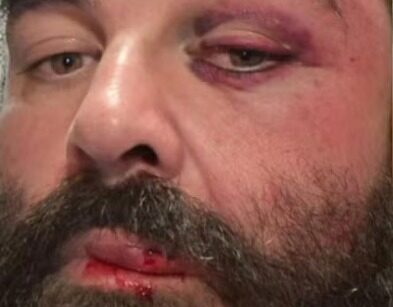 Homem agredido após reclamar de som SC