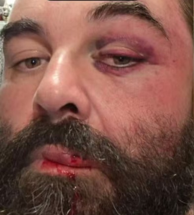 Homem agredido após reclamar de som SC