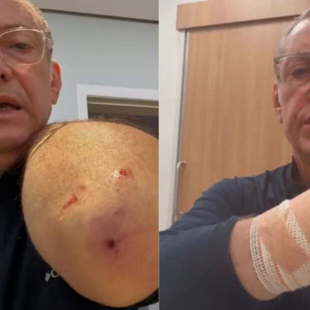 Entre curativos, pontos e um vídeo direto do Hospital Sírio-Libanês, Burnier transformou uma experiência pessoal em alerta público sobre segurança e cuidados com cães