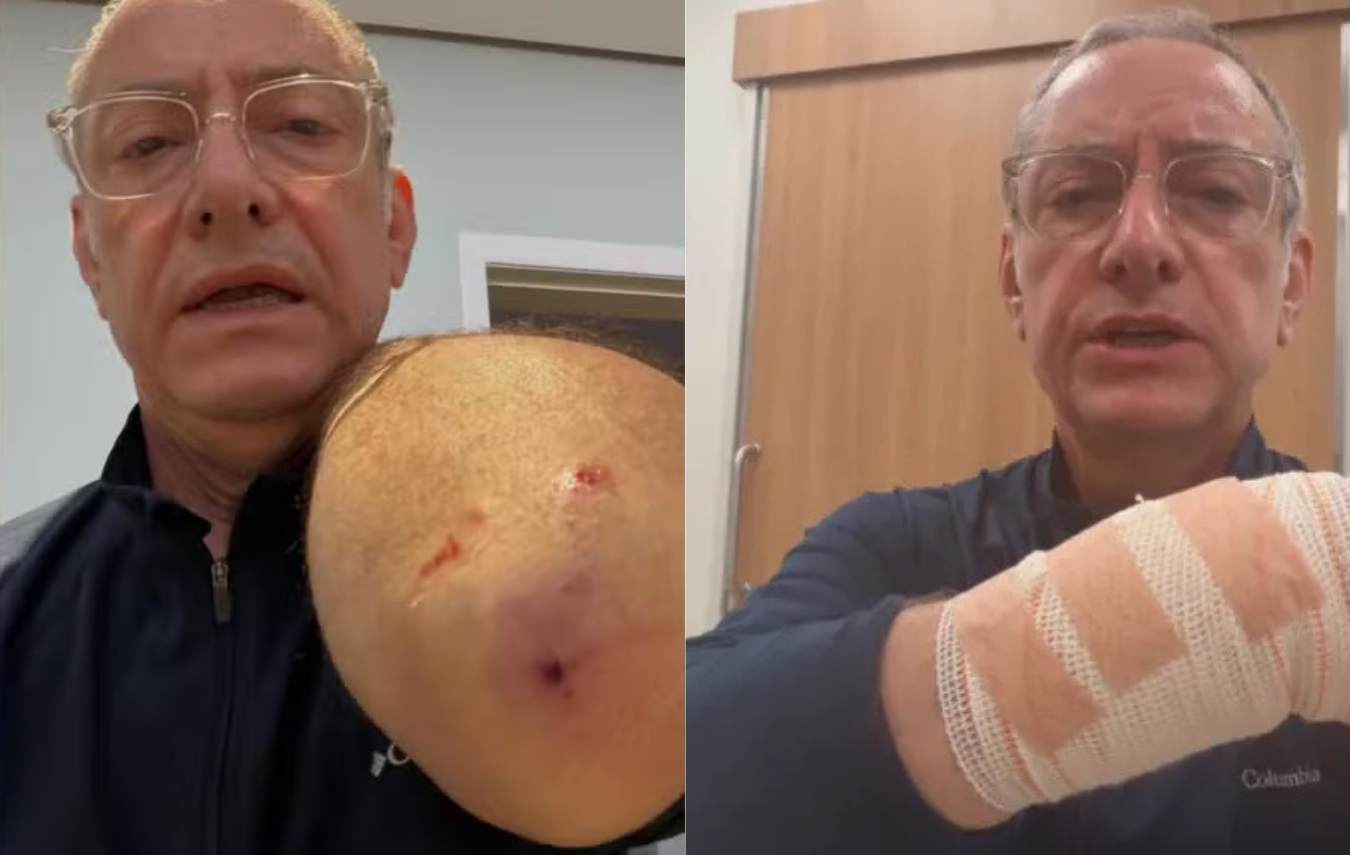 Entre curativos, pontos e um vídeo direto do Hospital Sírio-Libanês, Burnier transformou uma experiência pessoal em alerta público sobre segurança e cuidados com cães