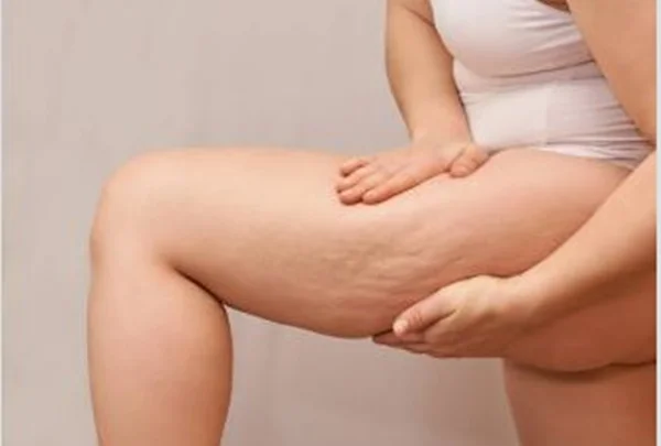 Joelhos, braços e lateral do quadril entraram para a lista de queixas nos consultórios. A explicação pode estar menos no corpo e mais na evolução das câmeras e das redes sociais.