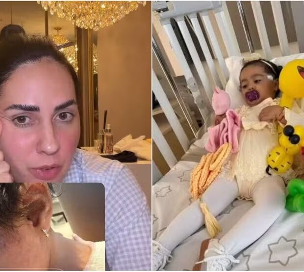 Graciele Lacerda revelou que a filha Clara, fruto do relacionamento com Zezé Di Camargo, passou por uma biópsia após exames identificarem nódulos sob uma mancha roxa no rosto. - Reprodução Instagram