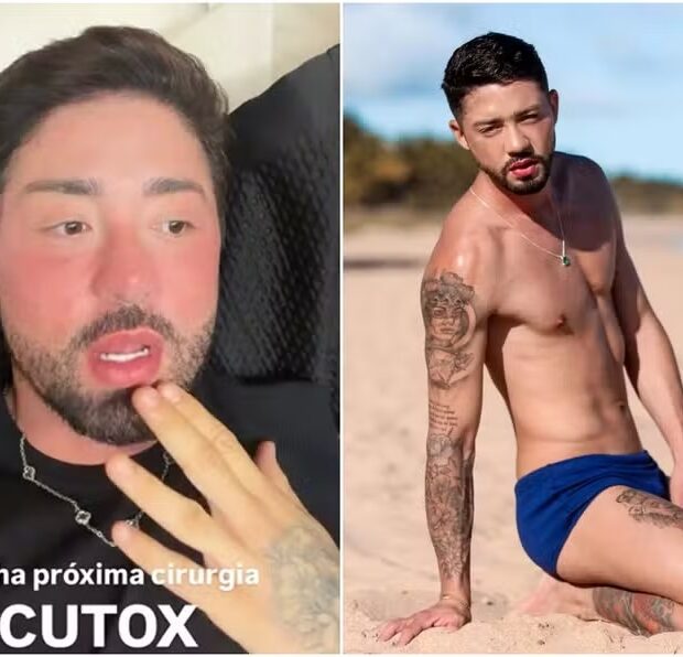 Rico Melquiades anunciou que pretende fazer harmonização anal